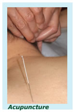 acupuncture needle